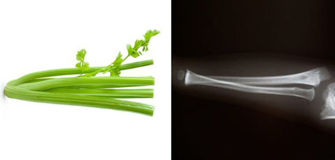 Celery – Bone